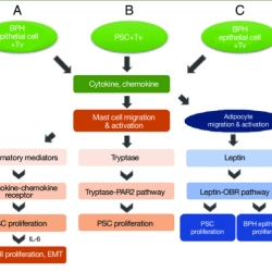 Hesi case study benign prostatic hyperplasia