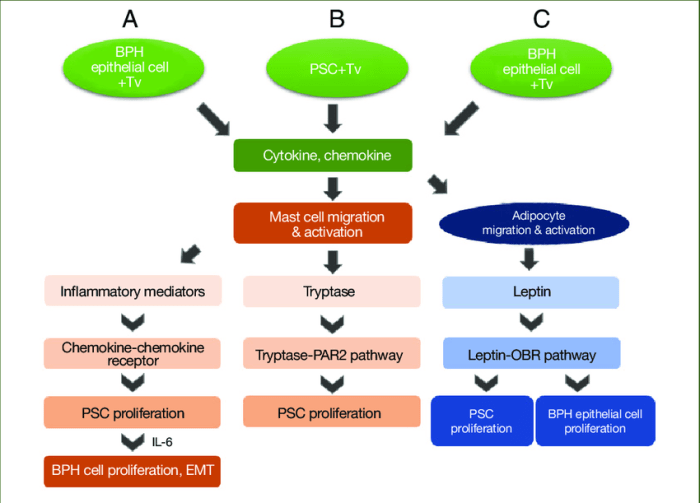 Hesi case study benign prostatic hyperplasia